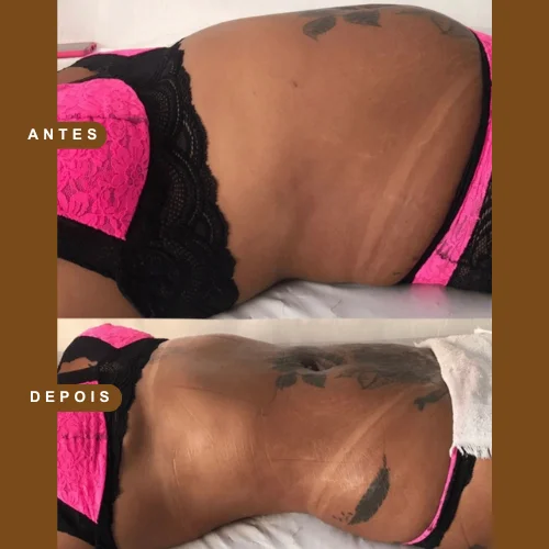 Resultado antes e depois 1